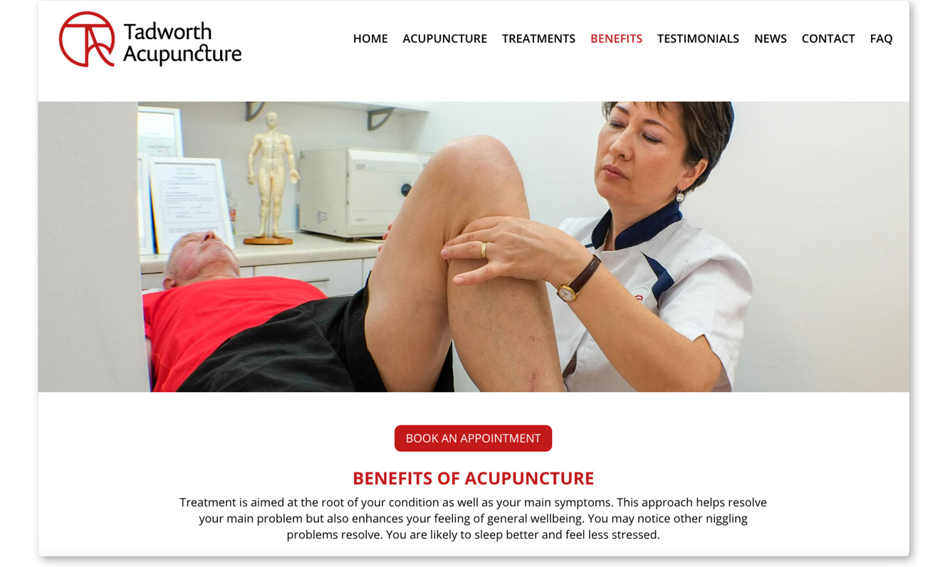 Tadworth Acupuncture web